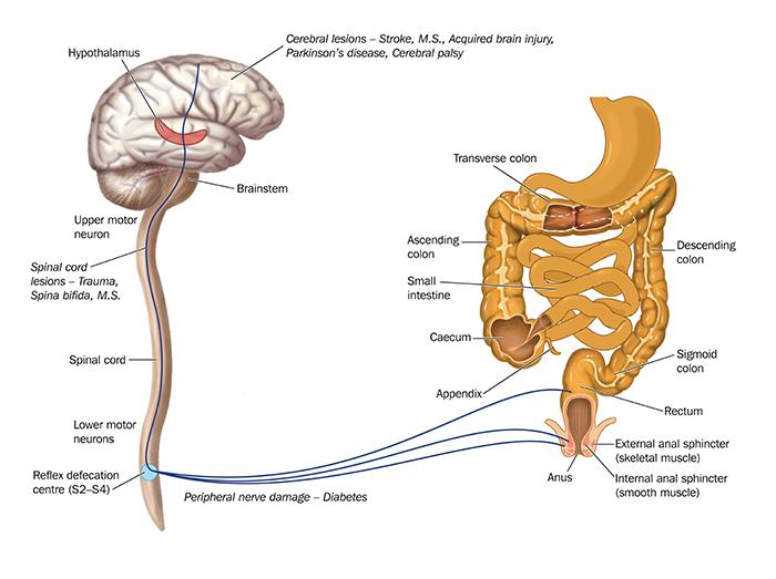 Illustrasjon av hjernen og nervene og deres sammenheng med tarmen