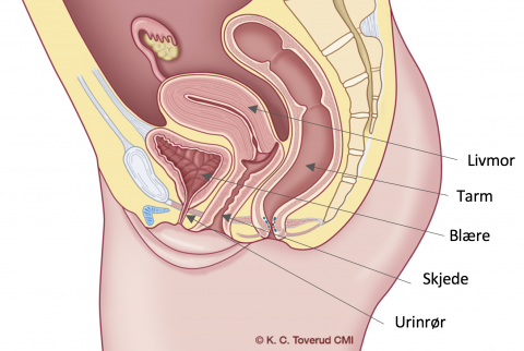 Tversnitt av et kvinnelig underliv som viser med piler hvor livmor, tarm, blære, skjede og urinrør er plassert
