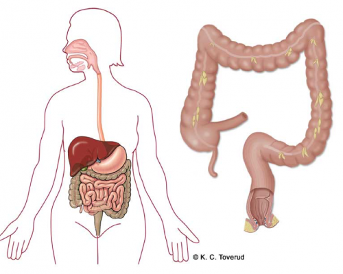 Illustrasjon av en kvinne som viser plassering av de indre organene, samt stor illustrasjon av tykktarm